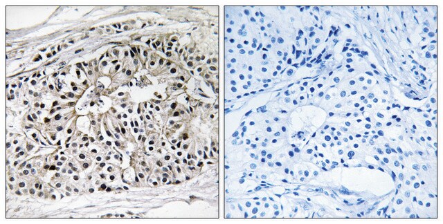 Anti-EHHADH antibody produced in rabbit affinity isolated antibody