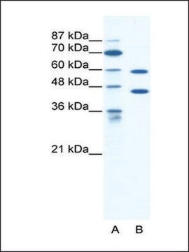 Anti-CATSPER2 (AB1) antibody produced in rabbit IgG fraction of antiserum