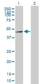 Anti-MMP28 antibody produced in rabbit purified immunoglobulin, buffered aqueous solution