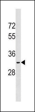 ANTI-NKX6-2 (N-TERM) antibody produced in rabbit IgG fraction of antiserum, buffered aqueous solution