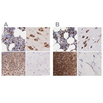 Anti-CKAP4 antibody produced in rabbit Ab2, Prestige Antibodies&#174; Powered by Atlas Antibodies, affinity isolated antibody, buffered aqueous glycerol solution