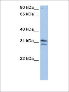 Anti-RG9MTD3 (AB1) antibody produced in rabbit affinity isolated antibody