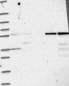 Anti-IFIT1 antibody produced in rabbit Prestige Antibodies&#174; Powered by Atlas Antibodies, affinity isolated antibody, buffered aqueous glycerol solution