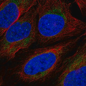 Anti-Acod1 Antibody Produced In Rabbit Prestige Antibodies&#174; Powered by Atlas Antibodies, affinity isolated antibody, buffered aqueous glycerol solution