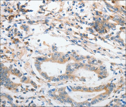 Anti-SLC15A2 antibody produced in rabbit affinity isolated antibody