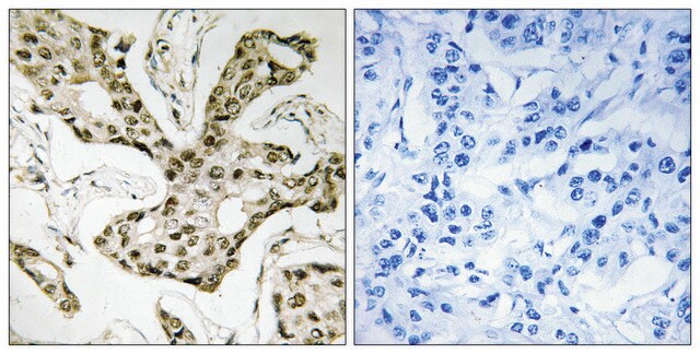 Anti-TOP2A antibody produced in rabbit affinity isolated antibody