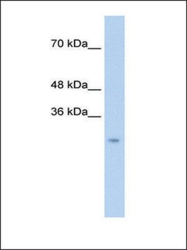 Anti-CTRL antibody produced in rabbit affinity isolated antibody