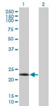 Anti-DYDC2 antibody produced in rabbit purified immunoglobulin, buffered aqueous solution