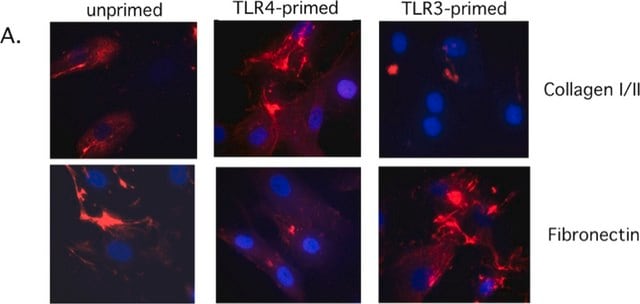 Anticorpo anti-collagene di tipo I, clone 5D8-G9 clone 5D8-G9, Chemicon&#174;, from mouse