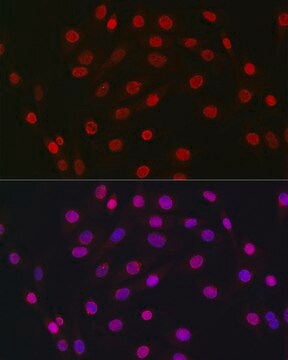 Anti-HDGF Antibody, clone 5U7A7, Rabbit Monoclonal