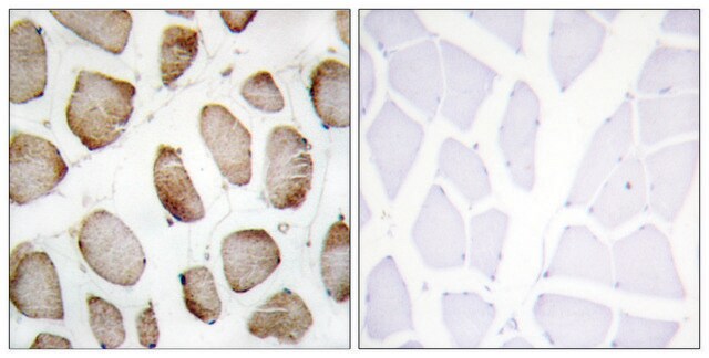 Anti-DUS2L antibody produced in rabbit affinity isolated antibody