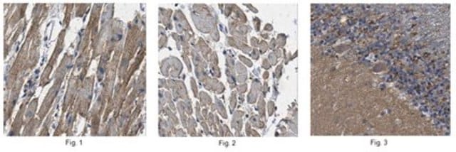 Anti-Pro-neuregulin-1, membrane-bound isoform (NRG1 Antibody) from rabbit, purified by affinity chromatography