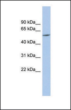 Anti-PRAME antibody produced in rabbit affinity isolated antibody