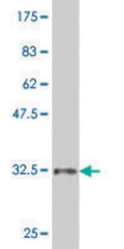 ANTI-ZIC1 antibody produced in mouse clone 4D2, purified immunoglobulin, buffered aqueous solution