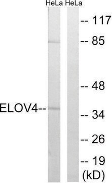 Anti-ELOVL4 antibody produced in rabbit affinity isolated antibody