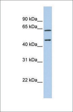 Anti-CECR1 antibody produced in rabbit affinity isolated antibody