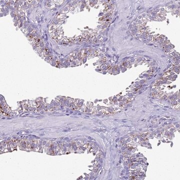 Anti-LRRC10B antibody produced in rabbit Prestige Antibodies&#174; Powered by Atlas Antibodies, affinity isolated antibody, buffered aqueous glycerol solution