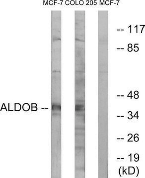 Anti-ALDOB antibody produced in rabbit affinity isolated antibody