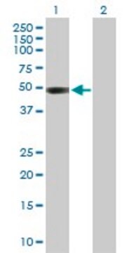 Anti-CTBS antibody produced in rabbit purified immunoglobulin, buffered aqueous solution