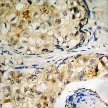 Anti-phospho-Tau (pThr205) antibody produced in rabbit affinity isolated antibody