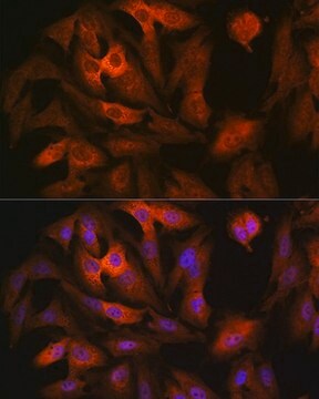 Anti-AGR2 antibody produced in rabbit