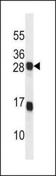 ANTI-KDELR2(C-TERMINAL) antibody produced in rabbit affinity isolated antibody, buffered aqueous solution