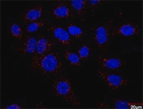 Monoclonal Anti-F13A1 antibody produced in mouse clone M1, purified immunoglobulin, buffered aqueous solution