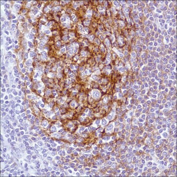 Anti-CD21 antibody, Rabbit monoclonal recombinant, expressed in proprietary host, clone SP199, affinity isolated antibody