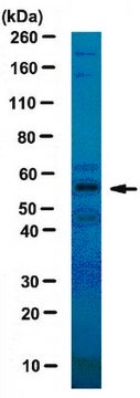 Anti-Katanin-like 1 (KL1) Antibody from rabbit, purified by affinity chromatography