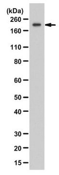 Anticorps anti-ZEB1 from rabbit, purified by affinity chromatography