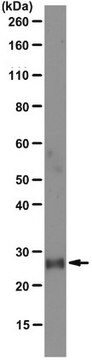 Anti-Folr4 (Folate receptor 4) Antibody, clone 5E12.2 clone 5E12.2, from mouse