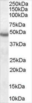 Anti-Neuroserpin antibody produced in goat affinity isolated antibody, buffered aqueous solution