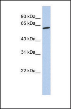 Anti-GPR75 antibody produced in rabbit affinity isolated antibody