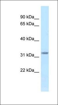 Anti-HSD17B11 antibody produced in rabbit affinity isolated antibody