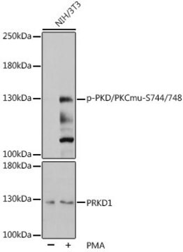 Anti-Phospho-PKD/PKCmu-S744/748 antibody produced in rabbit