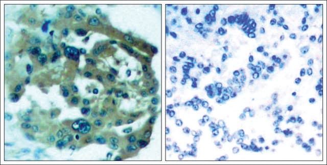 Anti-NF2 (Ab-518) antibody produced in rabbit affinity isolated antibody