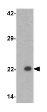 Anti-PHOX2B Antibody from rabbit, purified by affinity chromatography