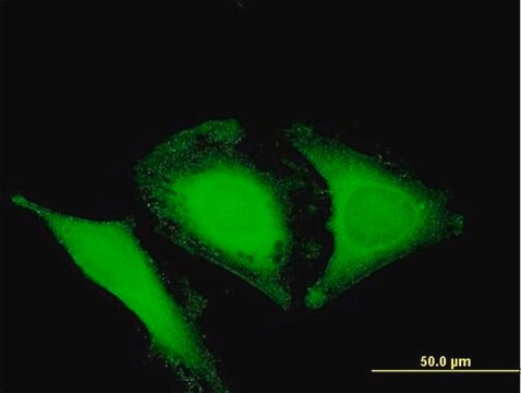 Anti-OPTN antibody produced in mouse purified immunoglobulin, buffered aqueous solution