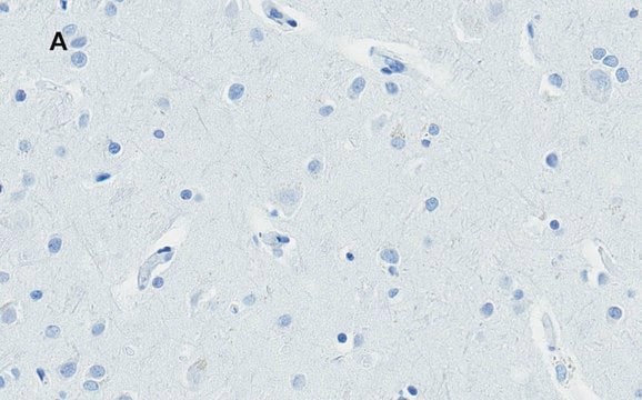 Anti-Huntingtin Protein Antibody, clone 1M11, ZooMAb&#174; Rabbit Monoclonal recombinant, expressed in HEK 293 cells