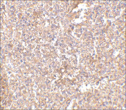 Anti-STEAP1 (ab2) antibody produced in rabbit affinity isolated antibody, buffered aqueous solution