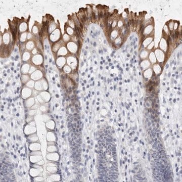 Anti-DNAJC11 antibody produced in rabbit Prestige Antibodies&#174; Powered by Atlas Antibodies, affinity isolated antibody, buffered aqueous glycerol solution