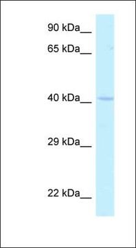 Anti-HOXA2 antibody produced in rabbit affinity isolated antibody