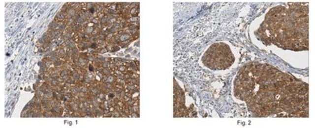 Anti-Hyaluronan synthase 2 Antibody, clone 2B11.1 clone 2B11.1, from mouse