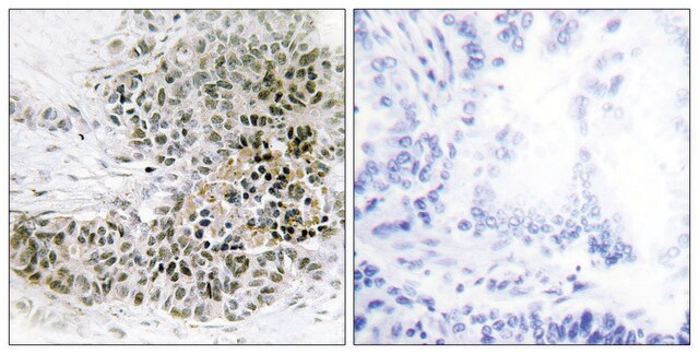 抗-TRPS1 兔抗 affinity isolated antibody