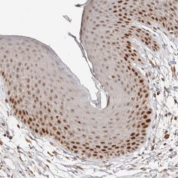 Anti-RFC2 antibody produced in rabbit Prestige Antibodies&#174; Powered by Atlas Antibodies, affinity isolated antibody, buffered aqueous glycerol solution