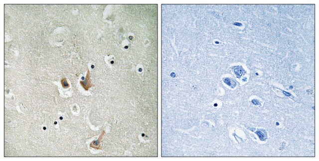 Anti-CKS2 antibody produced in rabbit affinity isolated antibody