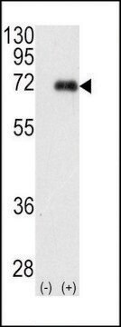 ANTI-PKC IOTA(N-TERMINAL) antibody produced in rabbit IgG fraction of antiserum, buffered aqueous solution