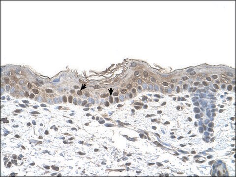 抗ARRB2抗体 ウサギ宿主抗体 affinity isolated antibody