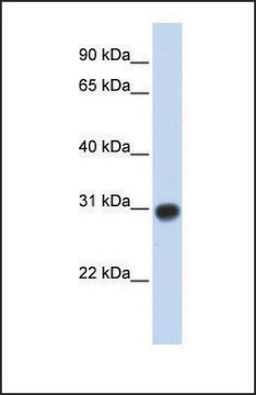 Anti-ZMYND19 antibody produced in rabbit affinity isolated antibody