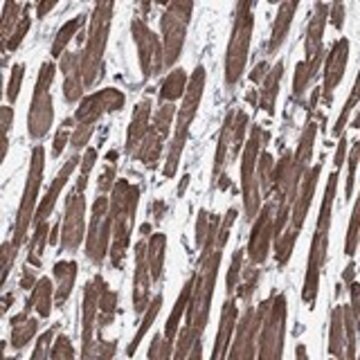 Anti-SCN7A antibody produced in rabbit Prestige Antibodies&#174; Powered by Atlas Antibodies, affinity isolated antibody, buffered aqueous glycerol solution